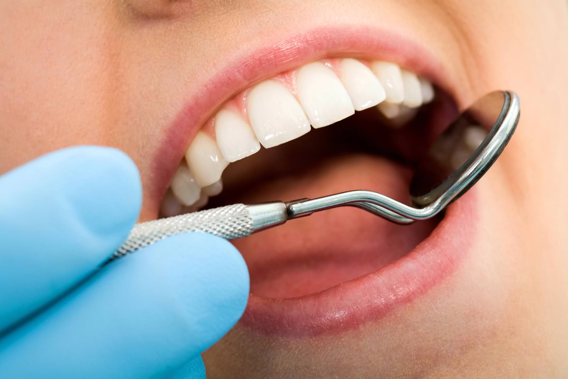 Things Your Dentist Wants You Know About Dental Exams 