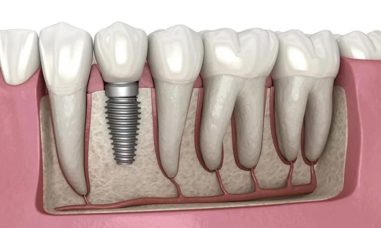 How Pediatric Dentists Evaluate Teeth That Appear Fused Or Joined Together